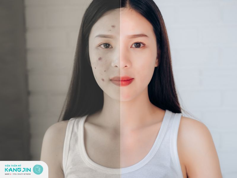 Yến mạch giúp cải thiện các khuyết điểm làn da hiệu quả