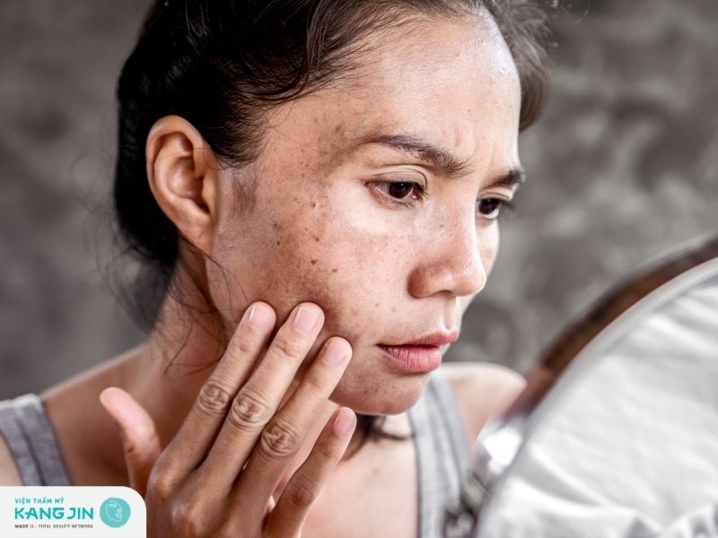 Chế độ ăn cải thiện tình trạng nám da