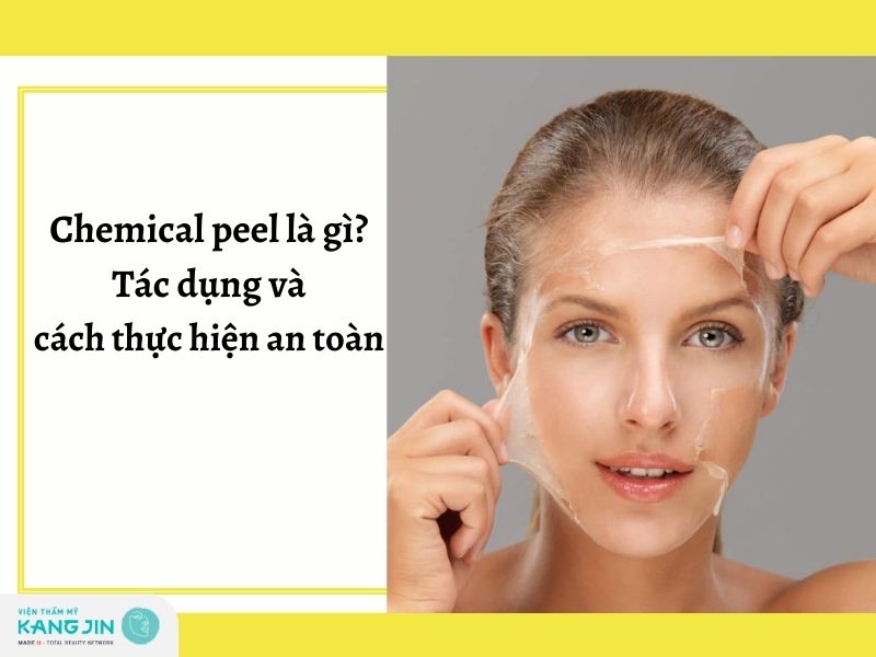 Chemical peel là gì