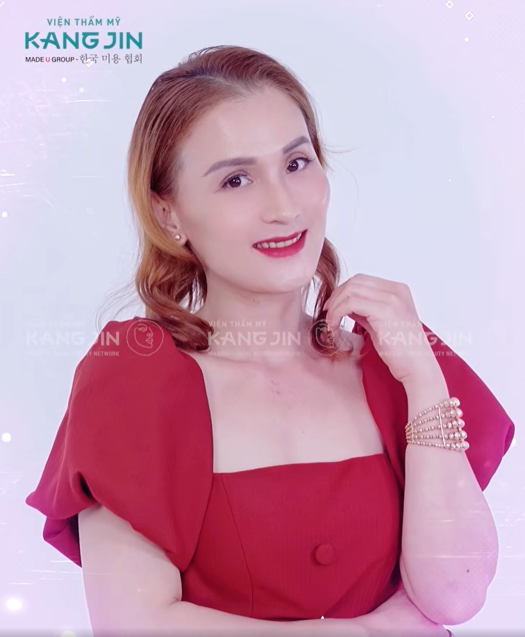 Chị Tuyết Loan tự tin với làn da “lão hóa ngược” nhờ Viện thẩm mỹ KangJin 