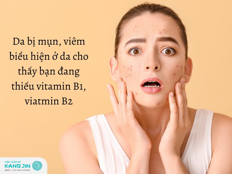 Biểu hiện ở da cho thấy bạn đang thiếu vitamin