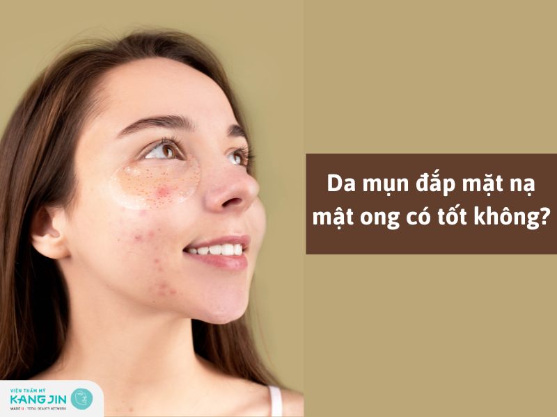 da mụn đắp mặt nạ mật ong tốt hay xấu