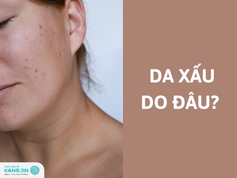 lý do vì sao da xấu