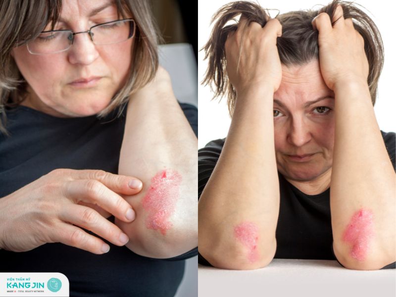 yếu tố di truyền và bệnh lý