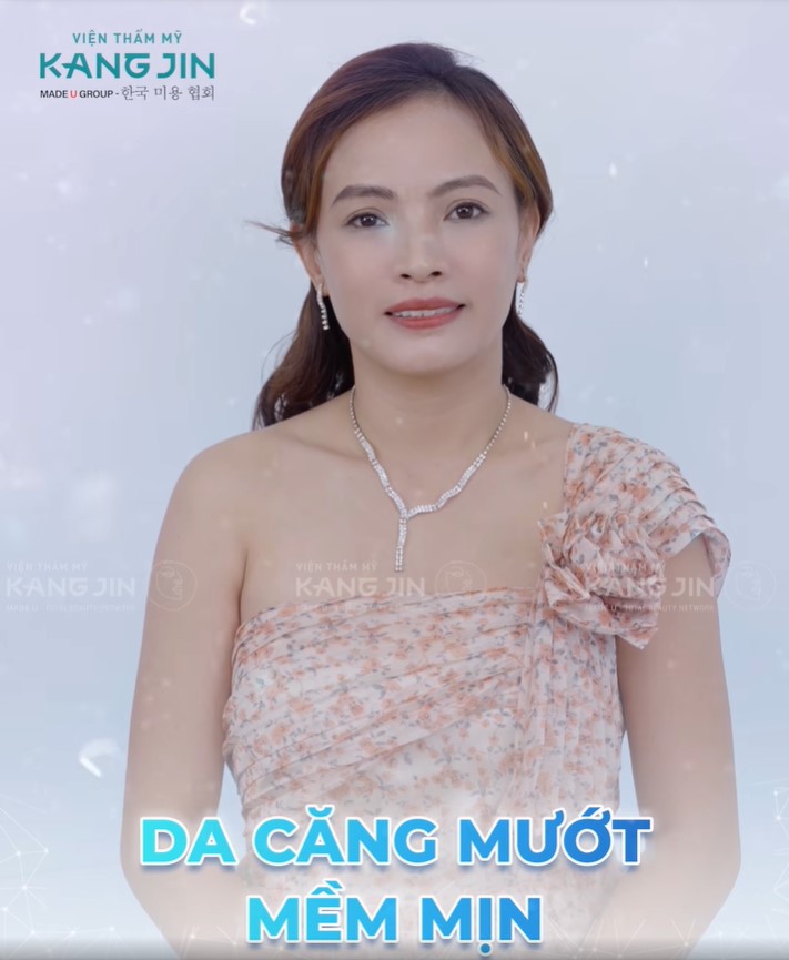 chị Hanah sau liệu trình