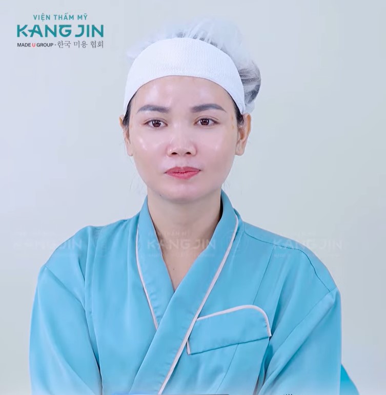 Làn da cải thiện rõ rệt sau khi thực hiện liệu pháp KangJin Maxcollagen Diamond Siêu Vi Điểm 