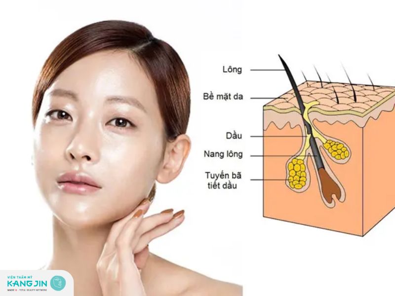 nguyên nhân gây da nhờn là gì?