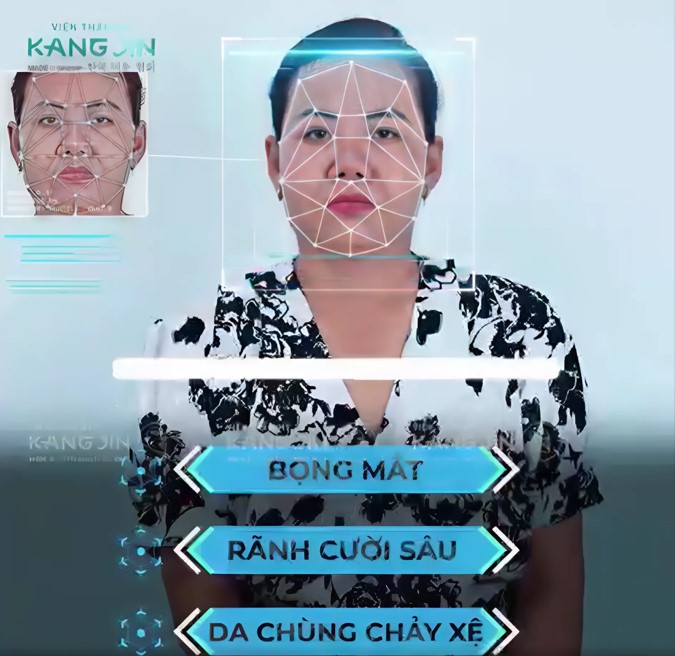 làn da của chị Phương Nhi trước khi trẻ hóa da