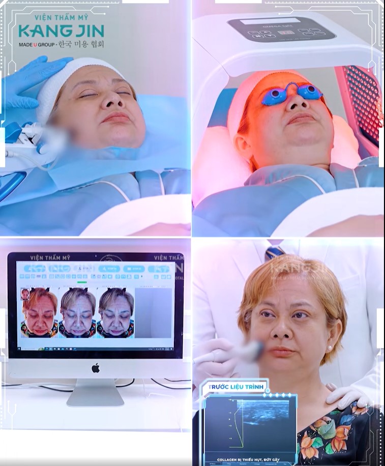 quy trình thực hiện liệu pháp trẻ hóa da