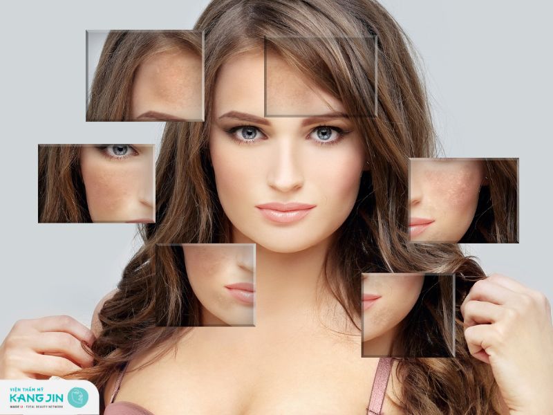 rối loạn sắc tố da