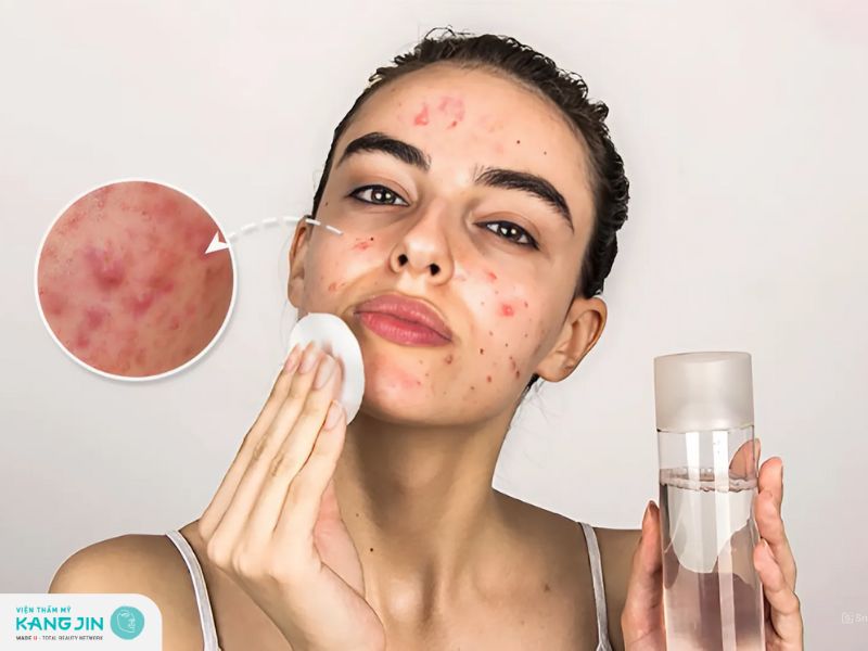 tác hại khi chọn sai mỹ phẩm