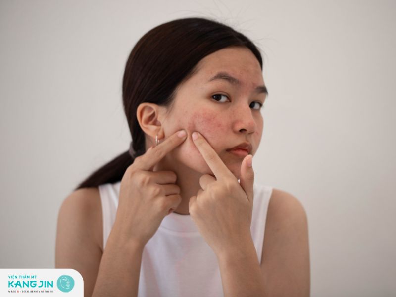 Một trong các tác dụng của tinh dầu tràm trà giảm mụn trứng cá