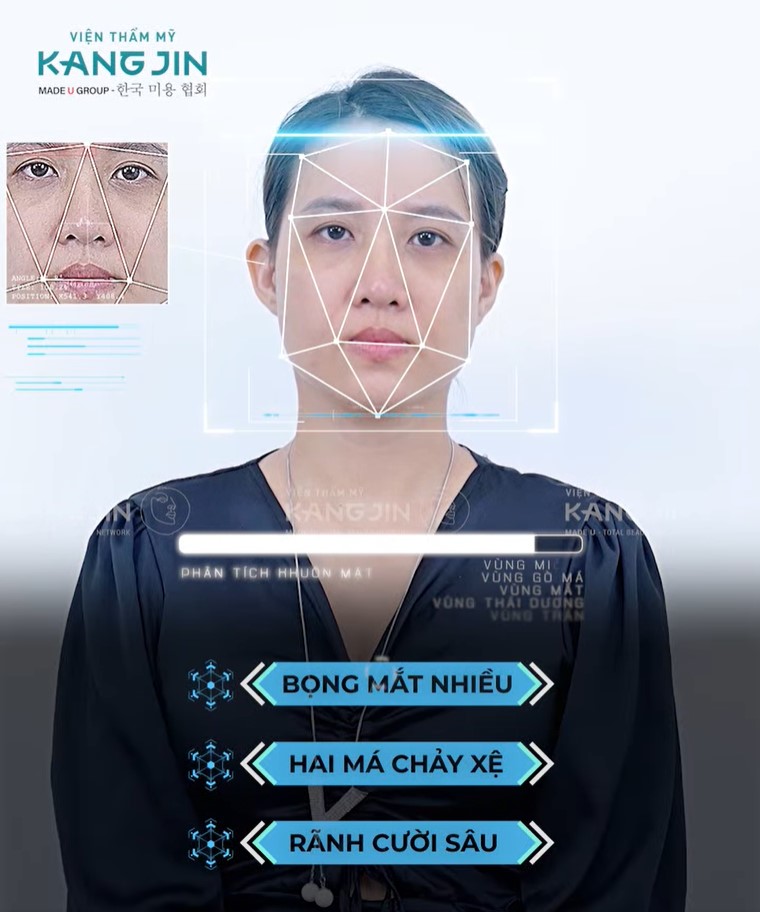 Tình trạng da của chị Út Lan trước khi thực hiện liệu trình trẻ hóa 