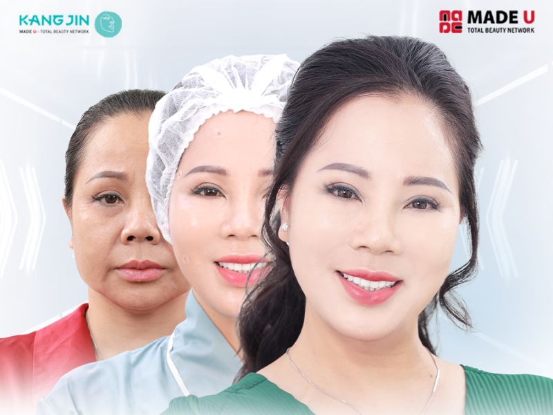 Hà Anh