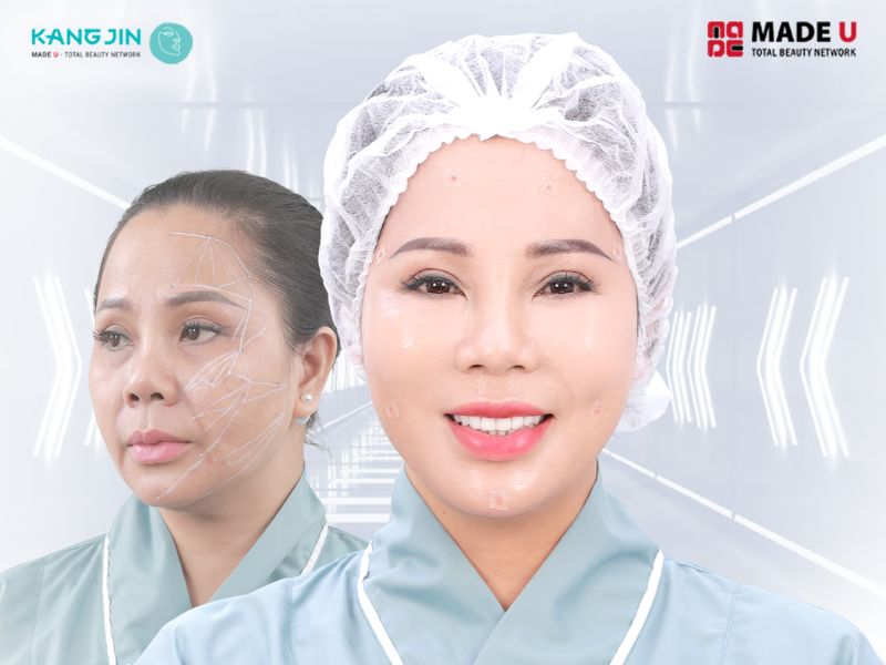 Hà Anh