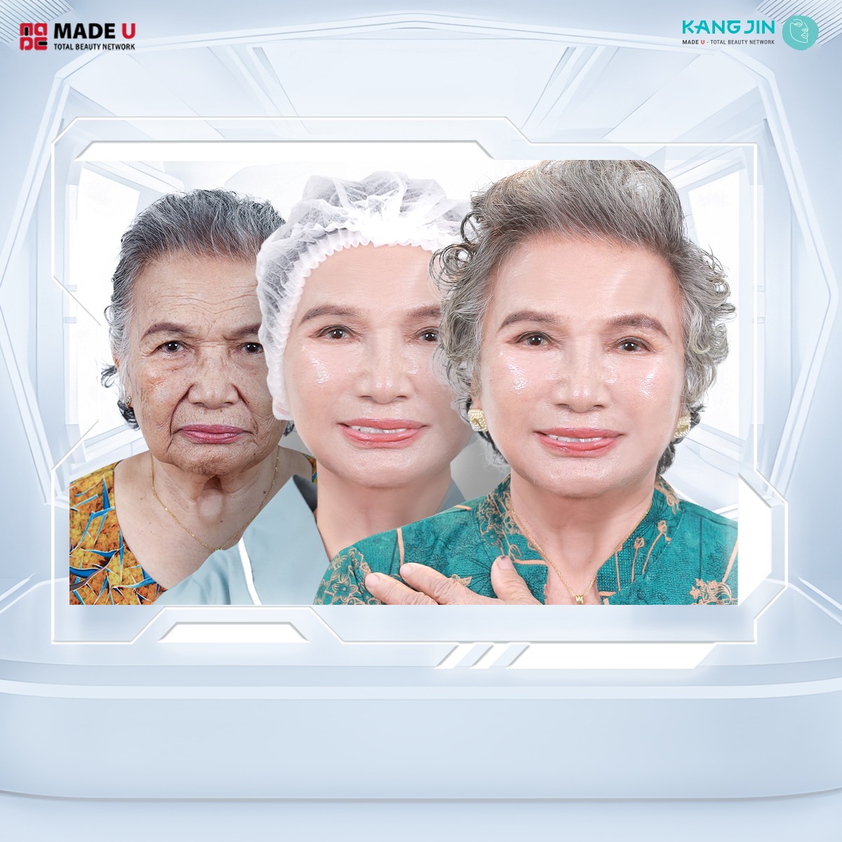 cô Vân sau điều trị