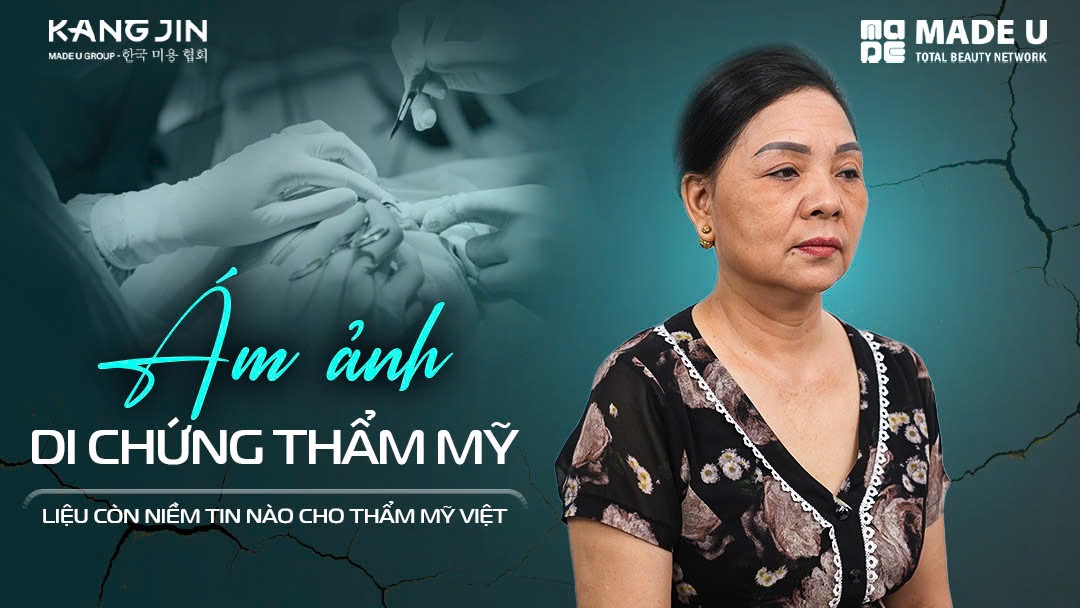 Chị Minh Xuân với nỗi ám ảnh di chứng thẩm mỹ