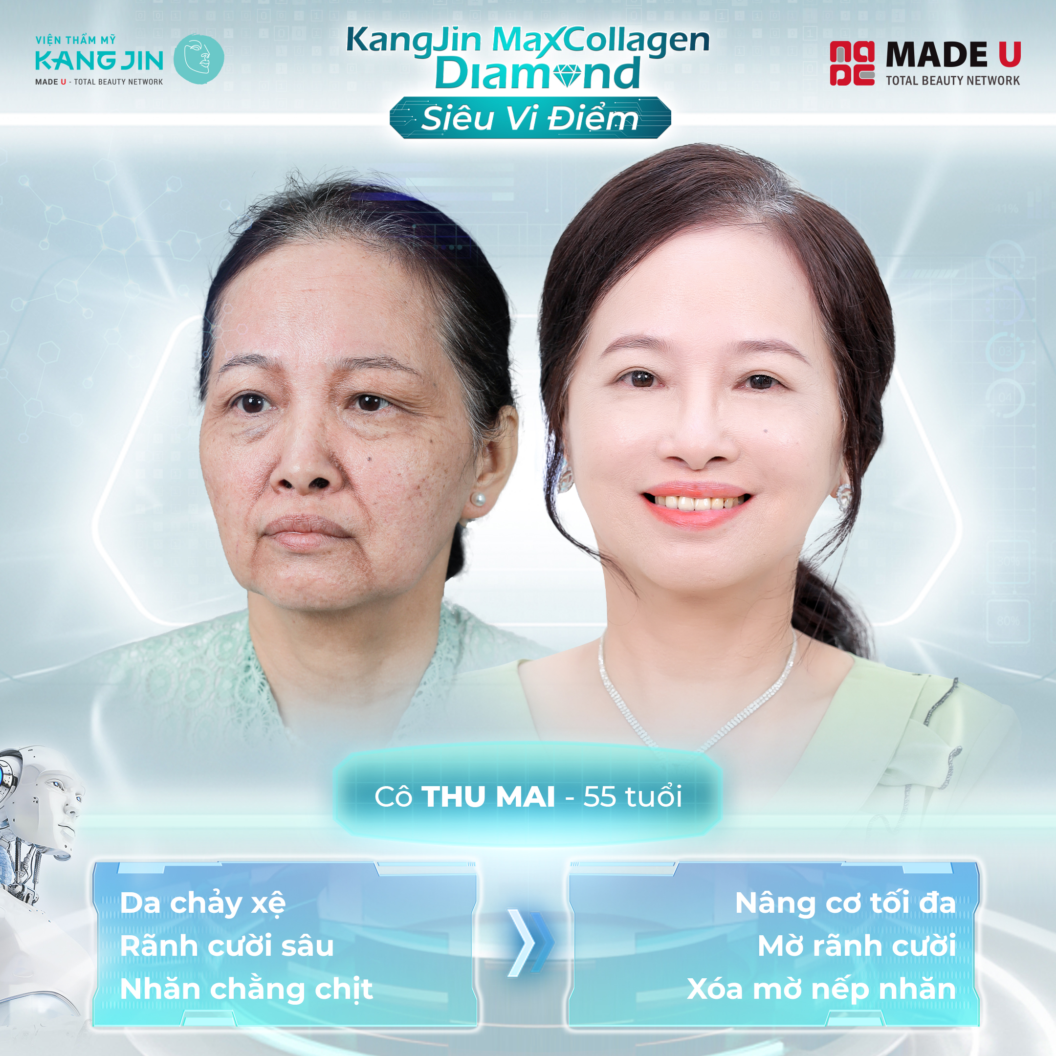 Khách hàng thực hiện trẻ hóa, xóa nhăn thành công