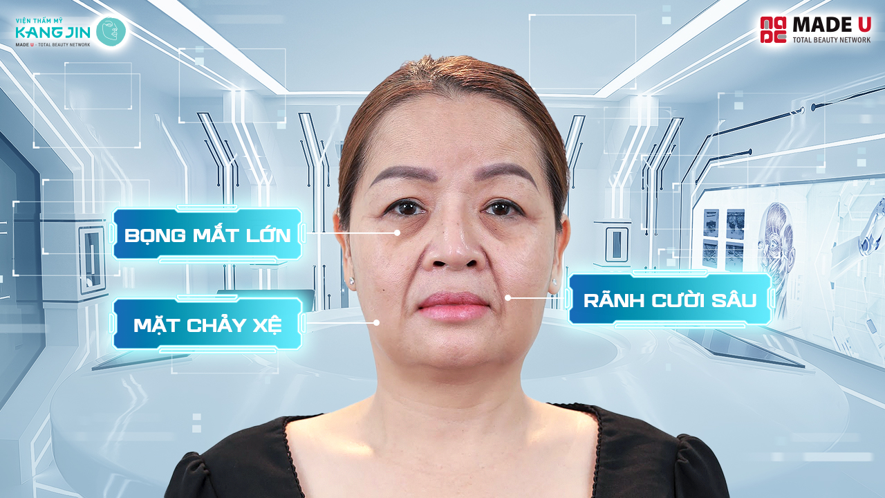 Tình trạng da của chị Hảo trước liệu trình