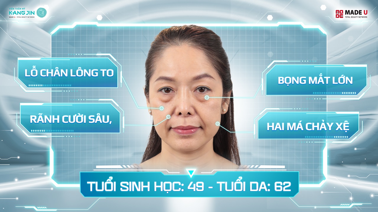 Tình trạng da của chị Huyền