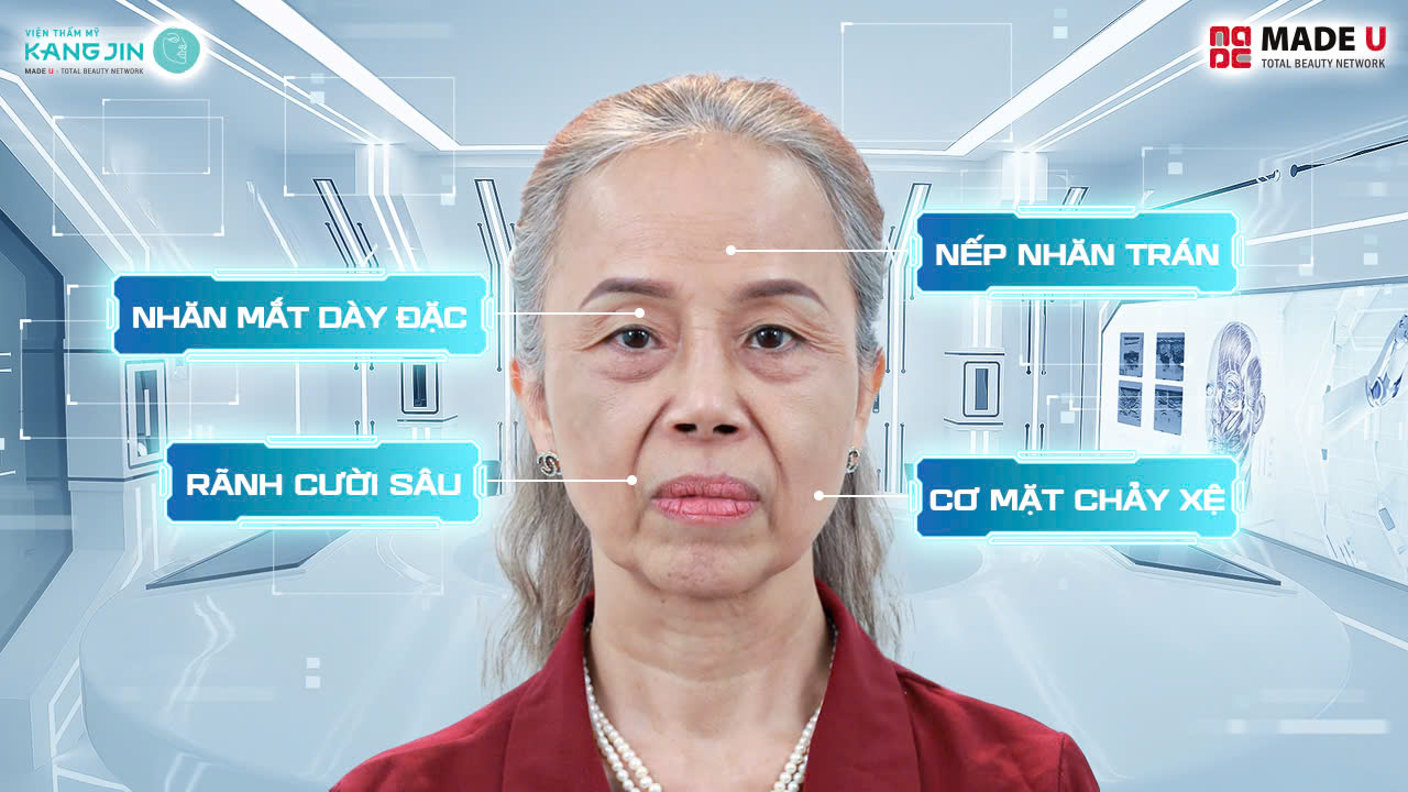 Tình trạng da của cô Thoa trước điều trị