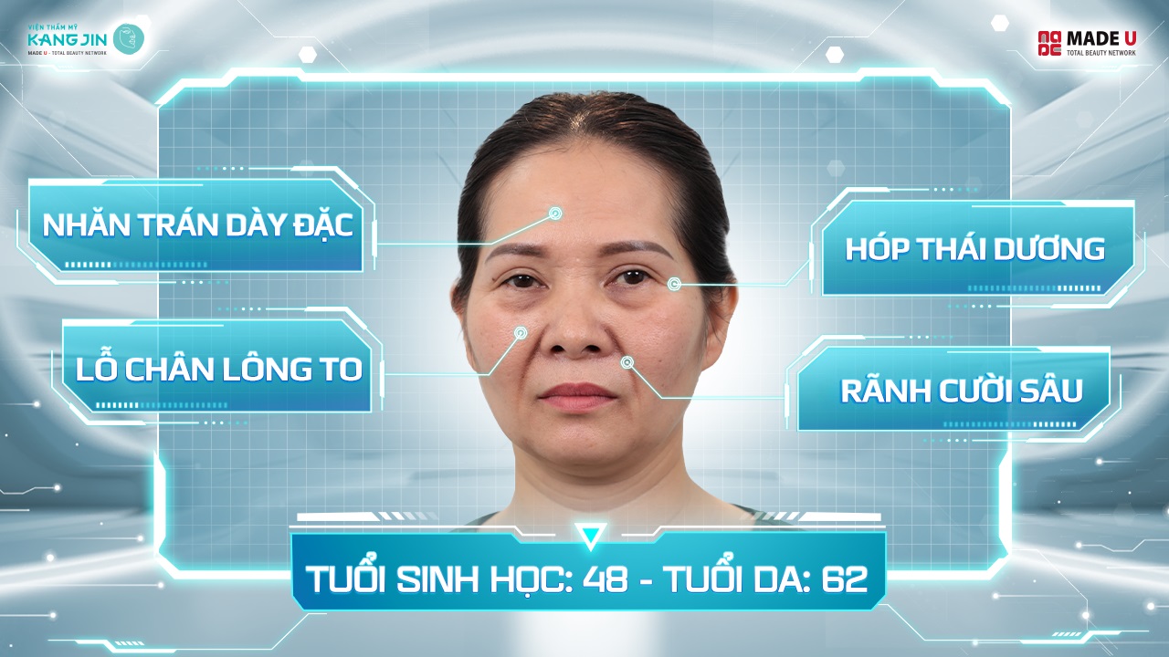 Tình trạng da của cô Hải