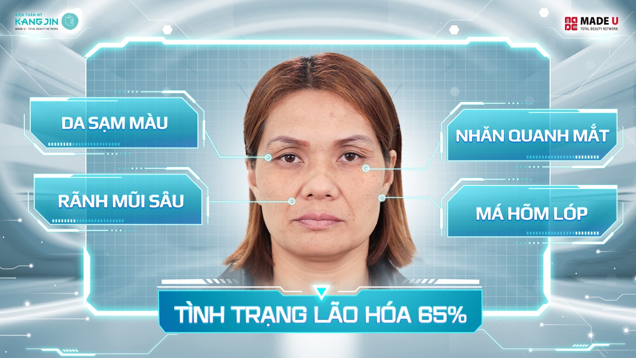 Tình trạng da trước kia của chị Hiền