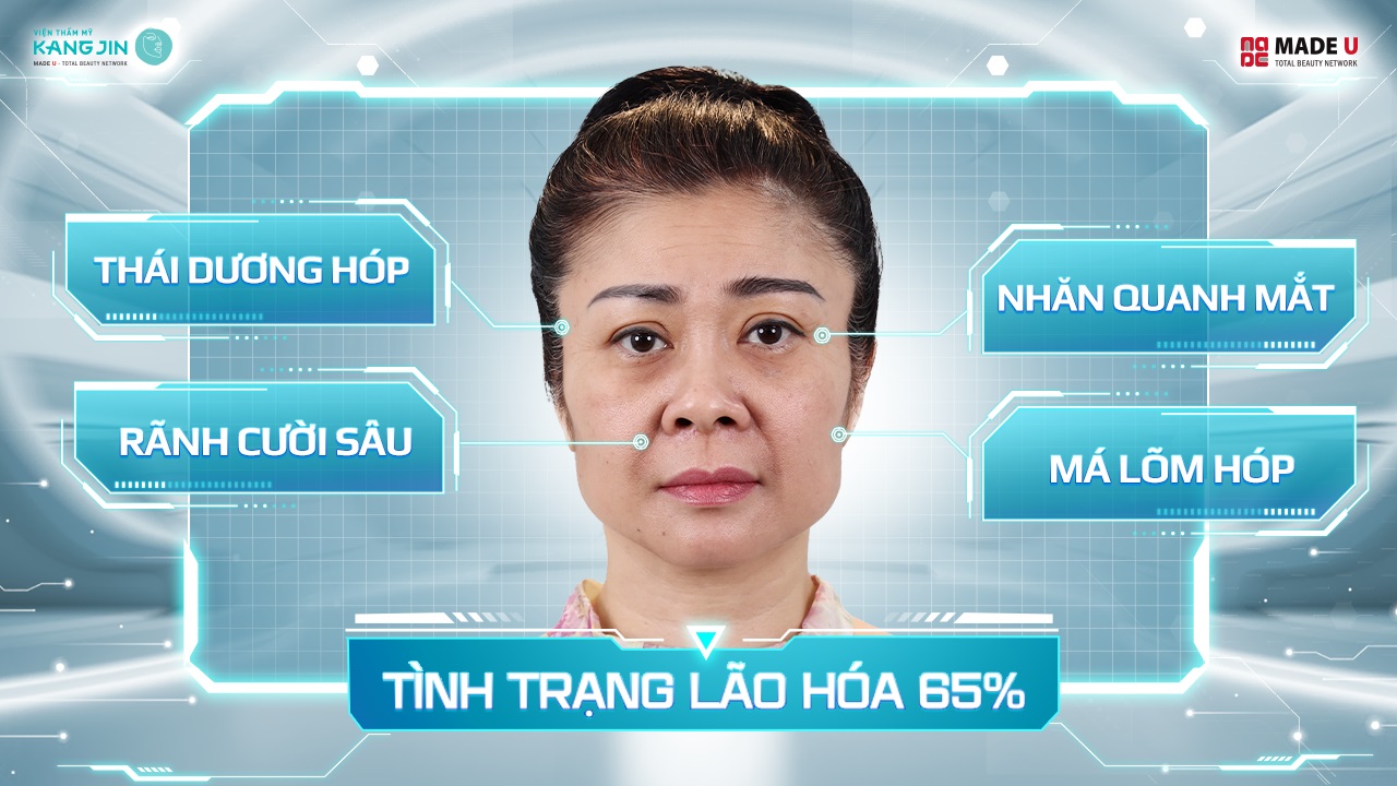 da của chị Lan Hương trước khi thực hiện liệu trình