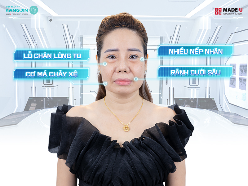 kết quả phân tích qua máy soi da Skin Lab 5D