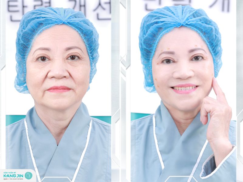 kangjin maxcollagen diamond