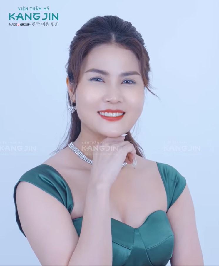 Chị Phương Vy tự tin với nhan sắc rạng rỡ sau khi thực trẻ hóa tại VTM Sejung