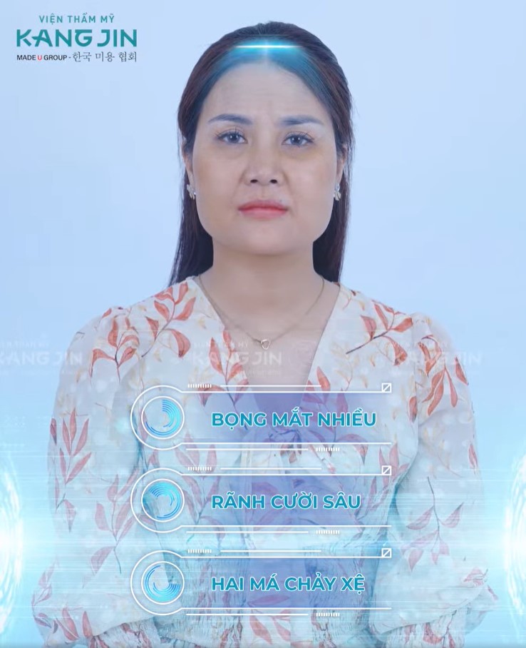 Làn da lão hóa với nhiều khuyết điểm của chị Phương Vy hậu giảm cân quá nhanh