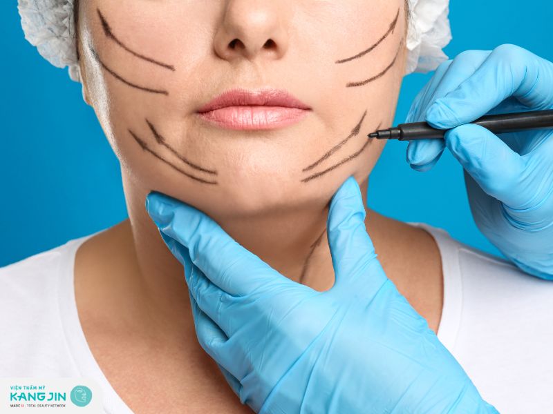 Các tác hại của căng chỉ collagen bạn cần biết