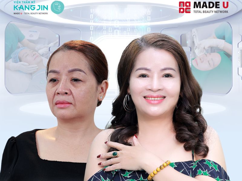 Da mặt chảy xệ: Nguyên nhân và cách khắc phục hiệu quả