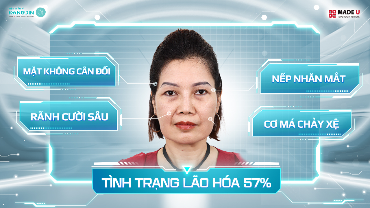 tình trạng làn da lão hóa của chị Anna Lê
