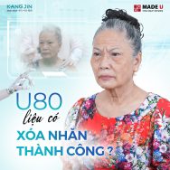 U80 liệu có quá muộn màng để làm đẹp không?