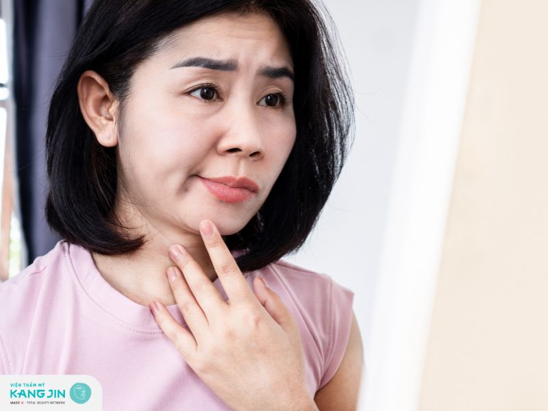 Người có làn da chảy xệ, nếp nhăn mới có thể thực hiện căng chỉ collagen 