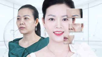 Cập nhật giá xóa râu rồng mới nhất – Bạn cần biết!