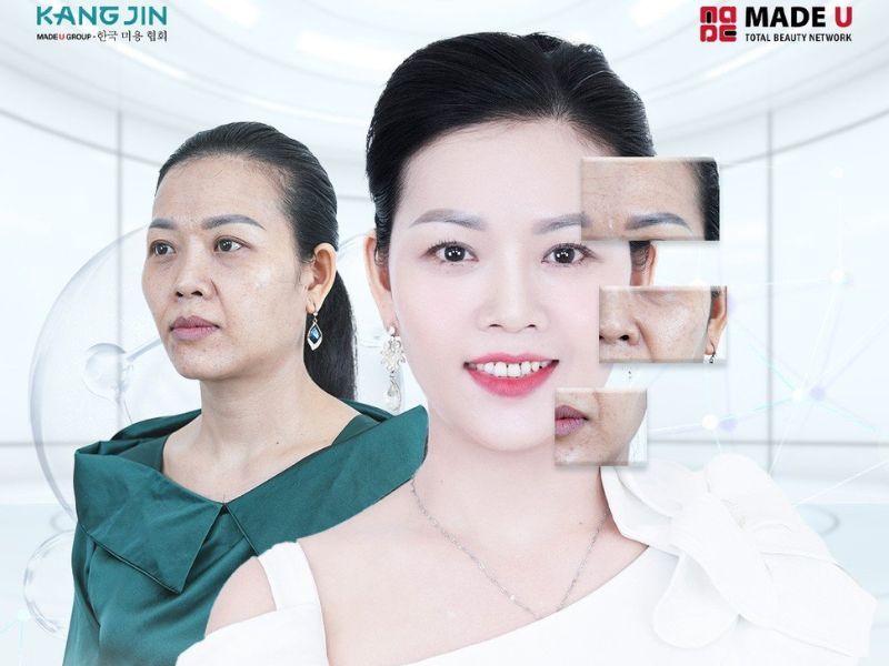 Cập nhật giá xóa râu rồng mới nhất 2024