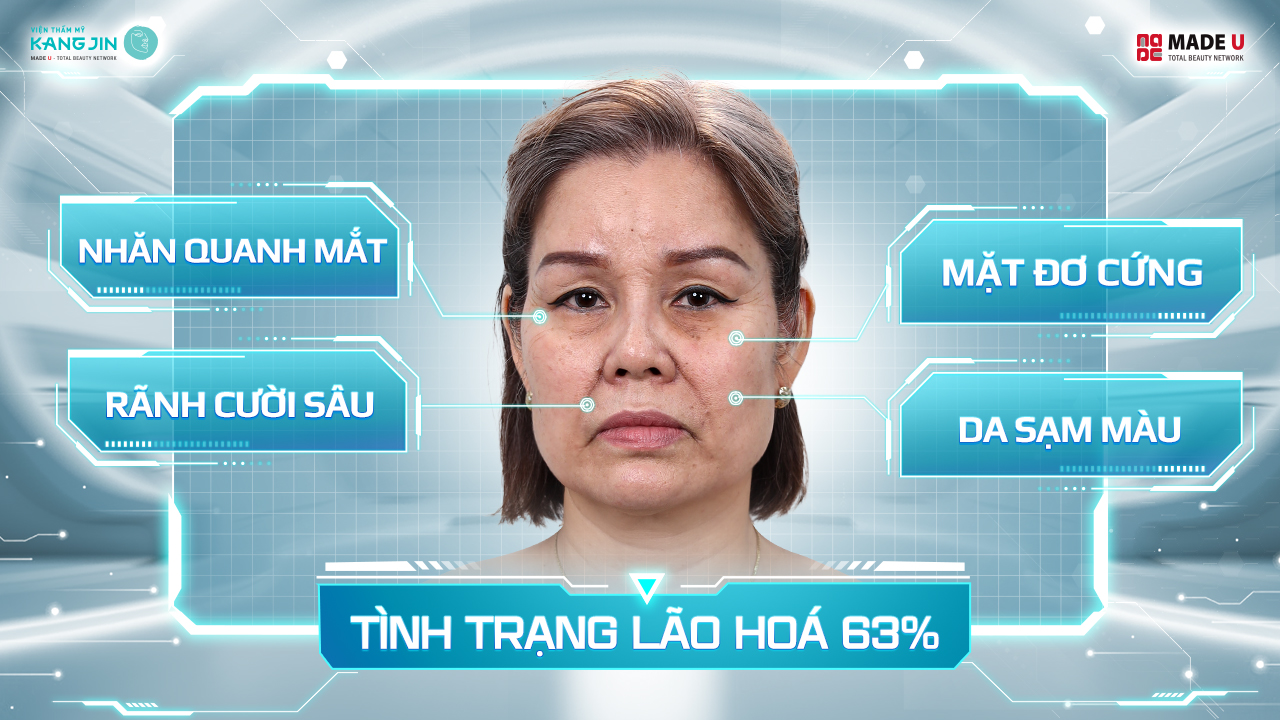 Làn da của chị Tina đã lão hóa nặng