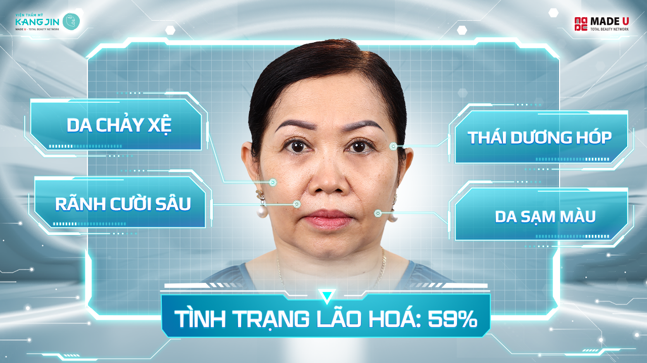 Tình trạng làn da của chị Elly Phạm trước điều trị