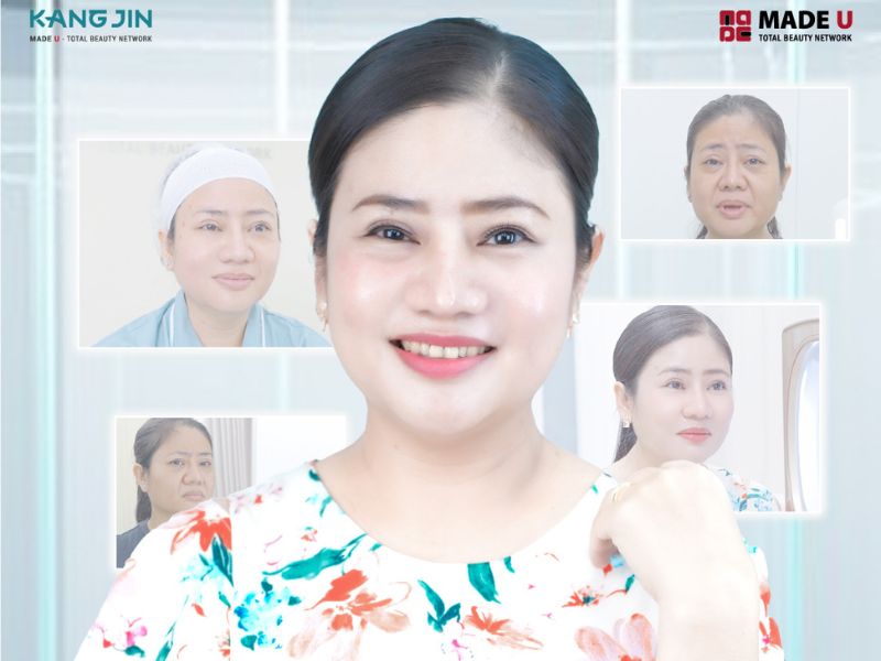 Cập nhật bảng giá liệu trình trẻ hóa da HOT 2024