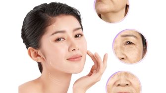 Căng chỉ collagen: Có phải là “phép màu” trẻ hóa làn da?