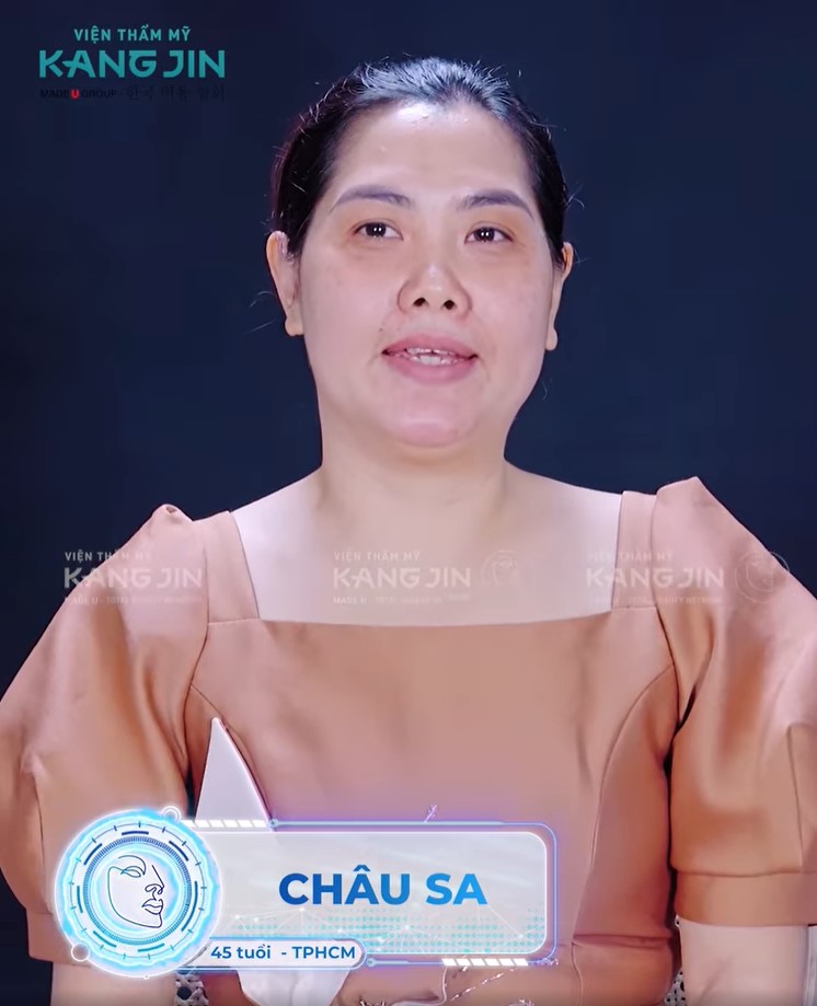 Làn da đen sạm chảy xệ và rãnh cười hằn sâu của chị Châu Sa
