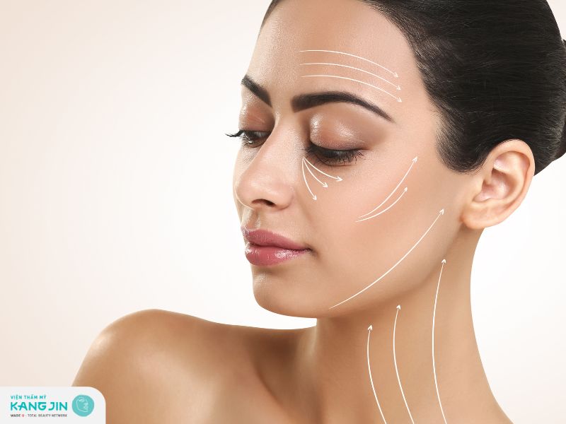 Cập nhật chi phí căng chỉ collagen năm 2024