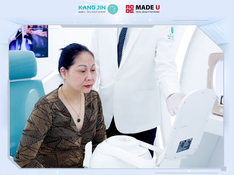 chi phí xóa nhăn ấn đường