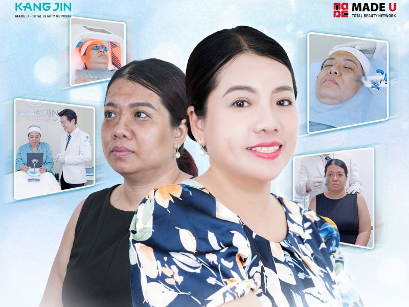 Bí kíp “hồi xuân” khắc phục da bị chùng nhão hiệu quả hiện nay