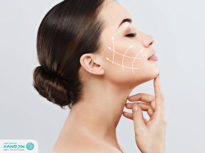 Chi phí căng chỉ xóa râu rồng 