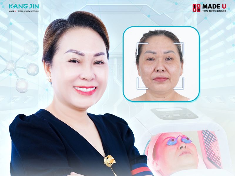 Hình ảnh làn da của khách hàng sau khi trẻ hóa da tại Viện thẩm mỹ KangJin 