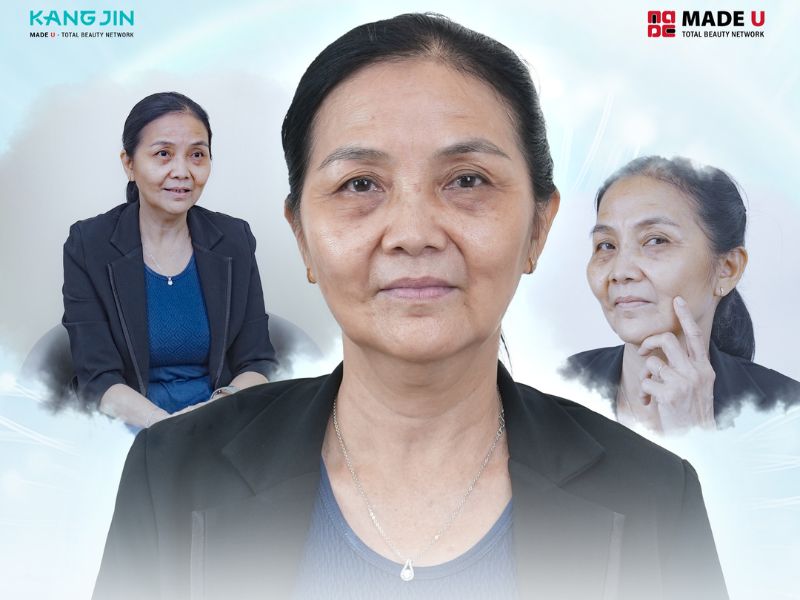 Làn của cô Mai Thị với các dấu hiệu lão hóa rõ rệt